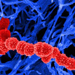 Hammerschmidt, S., S. Wolff, A. Hocke, S. Rosseau, E. Muller, and M. Rohde. 2005. Illustration of pneumococcal polysaccharide capsule during adherence and invasion of epithelial cells. Infect Immun 73:4653-4667.